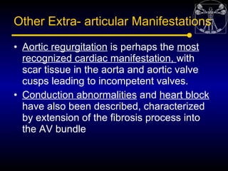 Other Extra- articular Manifestations

• Aortic regurgitation is perhaps the most
  recognized cardiac manifestation, with...