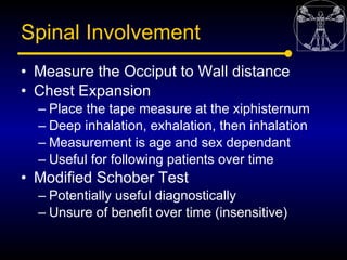 Spinal Involvement
• Measure the Occiput to Wall distance
• Chest Expansion
  – Place the tape measure at the xiphisternum...