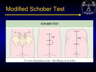 Modified Schober Test
 