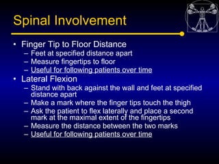 Spinal Involvement
• Finger Tip to Floor Distance
  – Feet at specified distance apart
  – Measure fingertips to floor
  –...