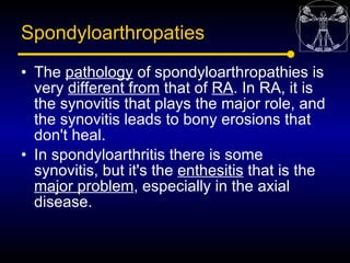 Spondyloarthropaties
• The pathology of spondyloarthropathies is
  very different from that of RA. In RA, it is
  the syno...