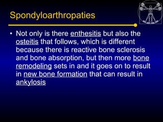 Spondyloarthropaties
• Not only is there enthesitis but also the
  osteitis that follows, which is different
  because the...