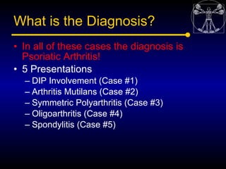 What is the Diagnosis?
• In all of these cases the diagnosis is
  Psoriatic Arthritis!
• 5 Presentations
  – DIP Involveme...