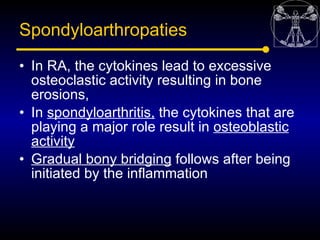 Spondyloarthropaties
• In RA, the cytokines lead to excessive
  osteoclastic activity resulting in bone
  erosions,
• In s...