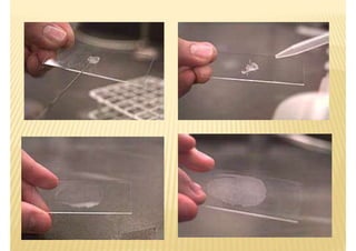 Staining Hand Eprocess 5. Staining techniques (Microbiology) | PDF