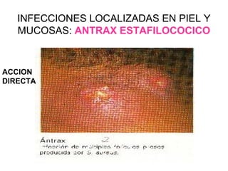 staphylococcus | PPT