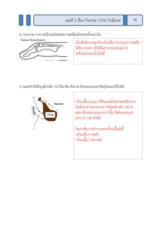 4. จากภาพ การบาดเจ็บจะส่งผลต่อการเคลื่อนไหวของนิ้วอย่างไร
5. ณเดชกาลังถือถุงผ้าหนัก 10 กิโลกรัม ดังภาพ ต้องออกแรงยกวัตถุด้วยแรงกี่นิวตัน
28.เล่มที่ 5 เรื่อง กิจกรรม STEM กับมือกล
เมื่อเอ็นยึดกระดูกกับกล้ามเนื้อ (Tendon) ขาดหรือ
ได้รับบาดเจ็บ ทาให้ไม่สามารถควบคุมการ
เคลื่อนไหวของนิ้วมือได้
กล้ามเนื้อ biceps ที่ต้นแขนมีกลศาสตร์เป็นคาน
อันดับสาม หมายความว่าวัตถุหนักจริง 100 N
แต่เราต้องออกแรงมากกว่านั้น จึงต้องออกแรง
มากกว่า 100 นิวตัน
โดยอาศัยการทางานของกล้ามเนื้อดังนี้
กล้ามเนื้อ B หดตัว
กล้ามเนื้อ T คลายตัว
 