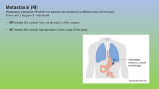 Metastasis (M)
Metastasis describes whether the cancer has spread to a different part of the body.
There are 2 stages of metastasis:
• M0 means the cancer has not spread to other organs
• M1 means the cancer has spread to other parts of the body
 