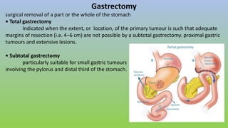 Gastrectomy
surgical removal of a part or the whole of the stomach
• Total gastrectomy
Indicated when the extent, or location, of the primary tumour is such that adequate
margins of resection (i.e. 4–6 cm) are not possible by a subtotal gastrectomy. proximal gastric
tumours and extensive lesions.
• Subtotal gastrectomy
particularly suitable for small gastric tumours
involving the pylorus and distal third of the stomach.
 