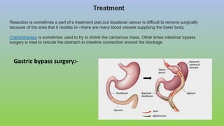 Treatment
Resection is sometimes a part of a treatment plan,but duodenal cancer is difficult to remove surgically
because of the area that it resides in—there are many blood vessels supplying the lower body.
Chemotherapy is sometimes used to try to shrink the cancerous mass. Other times intestinal bypass
surgery is tried to reroute the stomach to intestine connection around the blockage
Gastric bypass surgery:-
 