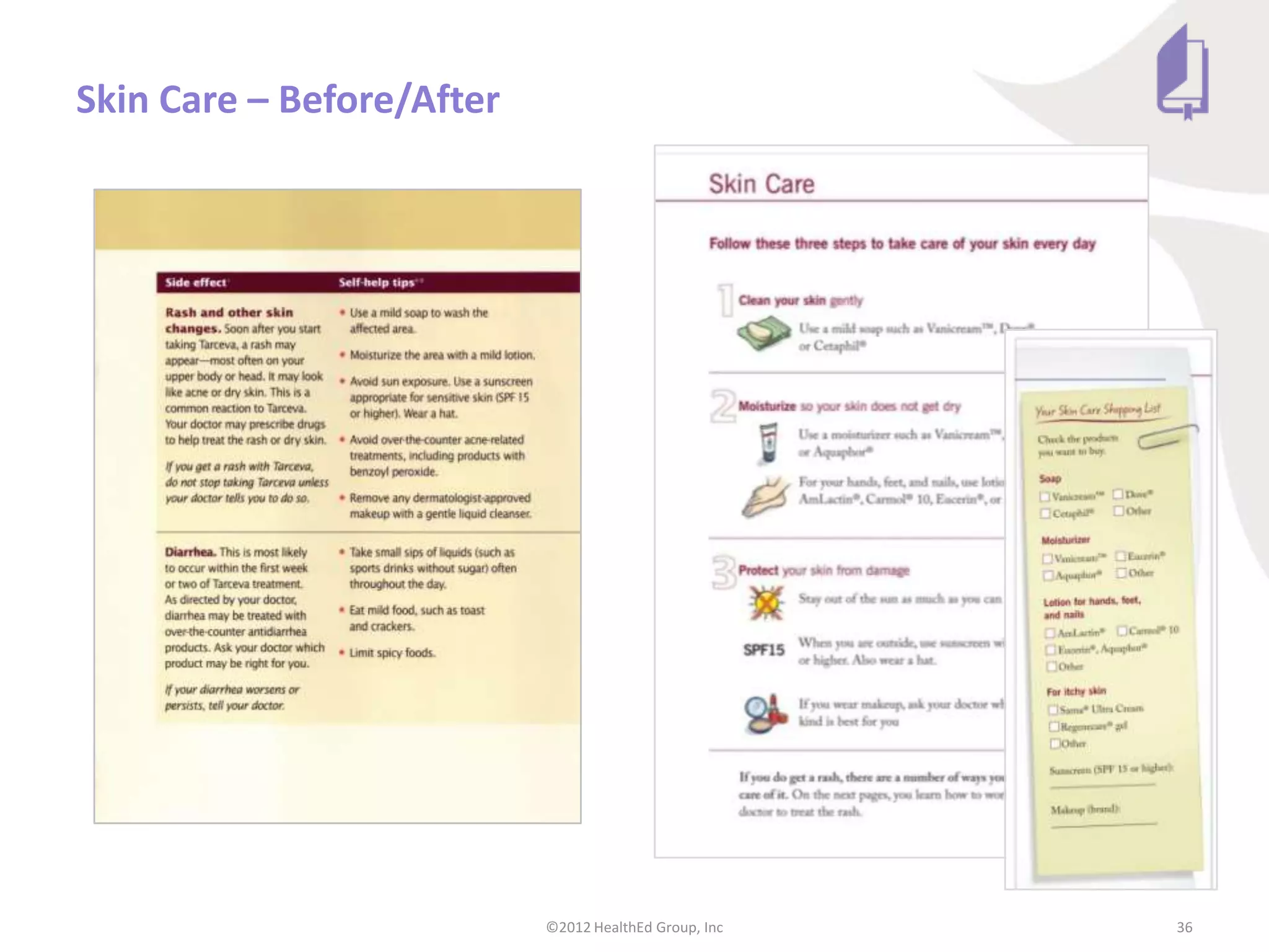 Skin Care – Before/After




                           ©2012 HealthEd Group, Inc   36
 