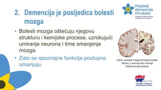 2. Demencija je posljedica bolesti
mozga
• Bolesti mozga oštećuju njegovu
strukturu i kemijske procese, uzrokujući
umiranje neurona i time smanjenje
mozga.
• Zato se spoznajne funkcije postupno
umanjuju.
Lijevo: presjek mozga zdravog čovjeka.
Desno, u kasnijoj fazi razvoja
Alzheimerove bolesti.
 