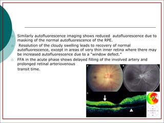 Window Defect Ffa Hyper 5_sudden_loss_of_vision_disorders.pdf