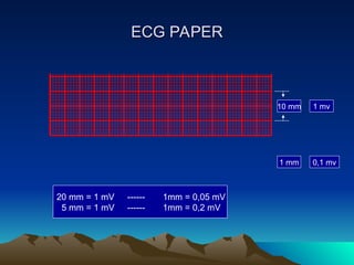 Comprehensive Fundamentals of Electrocardiogram (ECG) | PPT