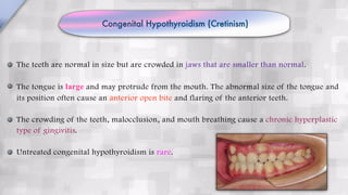 Congenital Hypothyroidism (Cretinism)
The teeth are normal in size but are crowded in jaws that are smaller than normal.
The tongue is large and may protrude from the mouth. The abnormal size of the tongue and
its position often cause an anterior open bite and flaring of the anterior teeth.
The crowding of the teeth, malocclusion, and mouth breathing cause a chronic hyperplastic
type of gingivitis.
Untreated congenital hypothyroidism is rare.
 