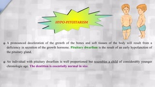 A pronounced deceleration of the growth of the bones and soft tissues of the body will result from a
deficiency in secretion of the growth hormone. Pituitary dwarfism is the result of an early hypofunction of
the pituitary gland.
An individual with pituitary dwarfism is well proportioned but resembles a child of considerably younger
chronologic age. The dentition is essentially normal in size.
HYPO-PITUITARISM
 