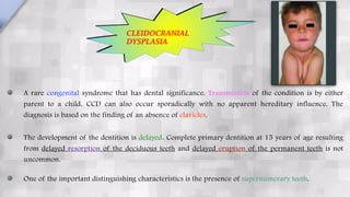 A rare congenital syndrome that has dental significance. Transmission of the condition is by either
parent to a child. CCD can also occur sporadically with no apparent hereditary influence. The
diagnosis is based on the finding of an absence of clavicles.
The development of the dentition is delayed. Complete primary dentition at 15 years of age resulting
from delayed resorption of the deciduous teeth and delayed eruption of the permanent teeth is not
uncommon.
One of the important distinguishing characteristics is the presence of supernumerary teeth. 
CLEIDOCRANIAL
DYSPLASIA
 