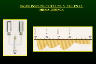 USO DE INSULINA CRITALINA Y NPH EN LA
MISMA JERINGA
 