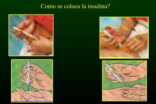 Como se coloca la insulina?
 