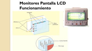 5ta Clase Monitor Multiparametros y tipos | PDF