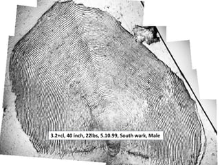 3.2+cl, 40 inch, 22lbs, 5.10.99, South wark, Male
 