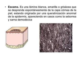 • Escama. Es una lámina blanca, amarilla o grisácea que 
se desprende espontáneamente de la capa córnea de la 
piel, estando originada por una queratinización anormal 
de la epidermis, apareciendo en casos como la seborrea 
y sarna demodécica 
 