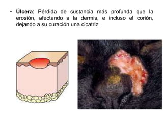 • Úlcera: Pérdida de sustancia más profunda que la 
erosión, afectando a la dermis, e incluso el corión, 
dejando a su curación una cicatriz 
 