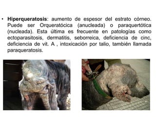 • Hiperqueratosis: aumento de espesor del estrato córneo. 
Puede ser Orqueratócica (anucleada) o paraquertótica 
(nucleada). Esta última es frecuente en patologías como 
ectoparasitosis, dermatitis, seborreica, deficiencia de cinc, 
deficiencia de vit. A , intoxicación por talio, también llamada 
paraqueratosis. 
 