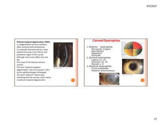 Pmd Confuse cornea stricture and disorders in the eye | PDF