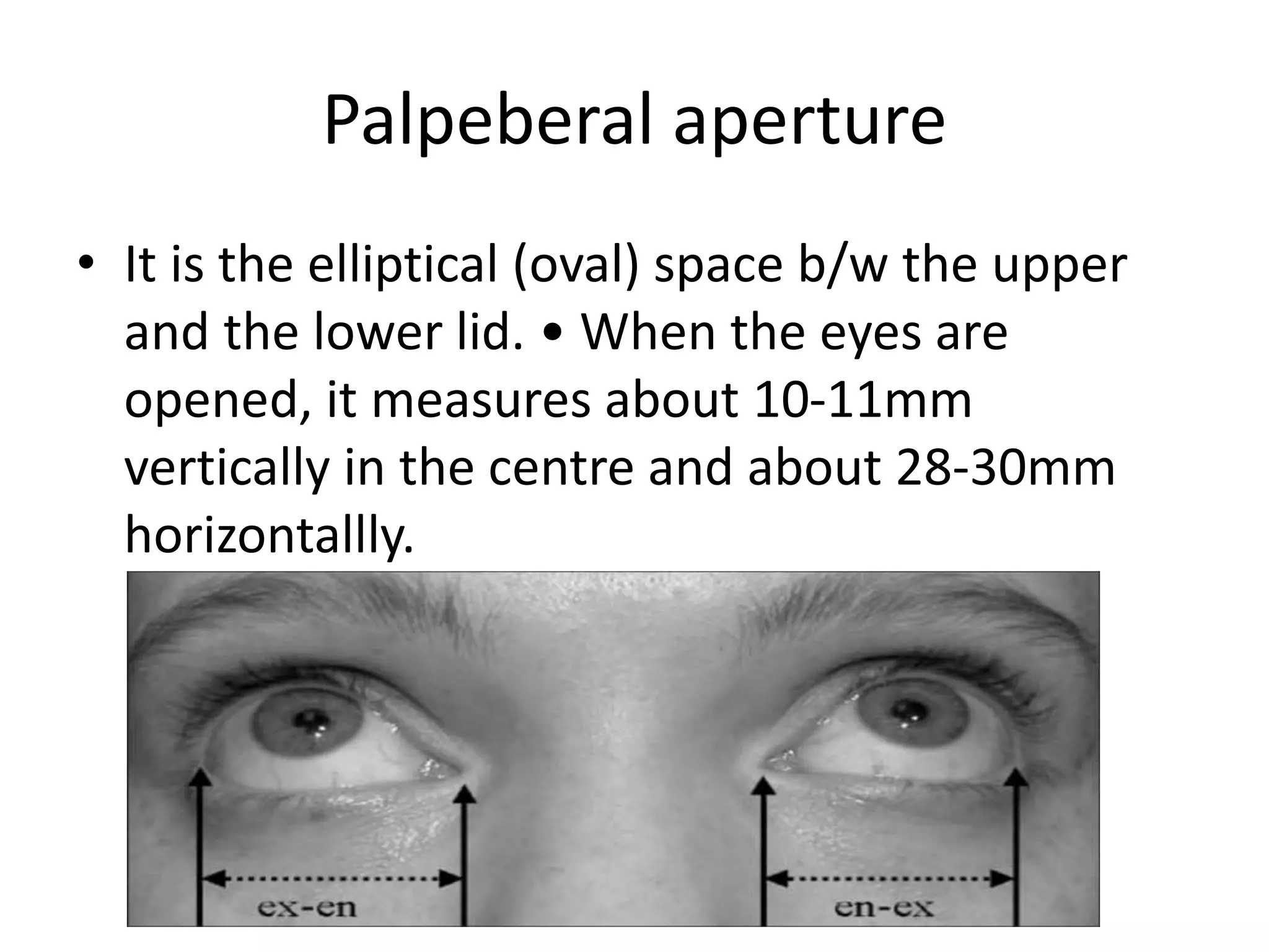 Palpeberal aperture
• It is the elliptical (oval) space b/w the upper
and the lower lid. • When the eyes are
opened, it measures about 10-11mm
vertically in the centre and about 28-30mm
horizontallly.
 