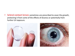 • Scleral contact lenses sometimes are prescribed to cover the growth,
protecting it from some of the effects of dryness or potentially from
further UV exposure.
 
