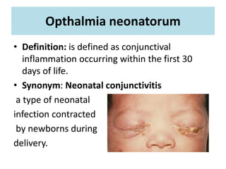 Opthalmia neonatorum
• Definition: is defined as conjunctival
inflammation occurring within the first 30
days of life.
• Synonym: Neonatal conjunctivitis
a type of neonatal
infection contracted
by newborns during
delivery.
 
