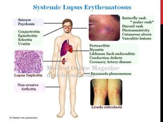 Dr Nidesh mds pedodontics
 