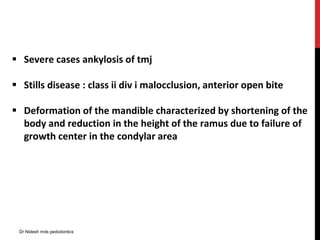  Severe cases ankylosis of tmj
 Stills disease : class ii div i malocclusion, anterior open bite
 Deformation of the mandible characterized by shortening of the
body and reduction in the height of the ramus due to failure of
growth center in the condylar area
Dr Nidesh mds pedodontics
 