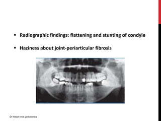  Radiographic findings: flattening and stunting of condyle
 Haziness about joint-periarticular fibrosis
Dr Nidesh mds pedodontics
 
