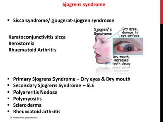 Sjogrens syndrome
 Sicca syndrome/ gougerat-sjogren syndrome
 Primary Sjogrens Syndrome – Dry eyes & Dry mouth
 Secondary Sjogrens Syndrome – SLE
 Polyareritis Nodosa
 Polymyositis
 Scleroderma
 Rheumatoid arthritis
Keratoconjunctivitis sicca
Xerostomia
Rhuematoid Arthritis
Dr Nidesh mds pedodontics
 