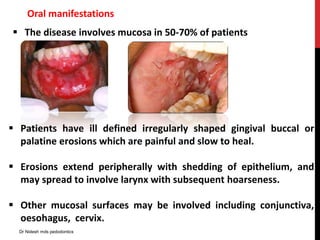  The disease involves mucosa in 50-70% of patients
 Patients have ill defined irregularly shaped gingival buccal or
palatine erosions which are painful and slow to heal.
 Erosions extend peripherally with shedding of epithelium, and
may spread to involve larynx with subsequent hoarseness.
 Other mucosal surfaces may be involved including conjunctiva,
oesohagus, cervix.
Oral manifestations
Dr Nidesh mds pedodontics
 