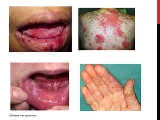 Dr Nidesh mds pedodontics
 