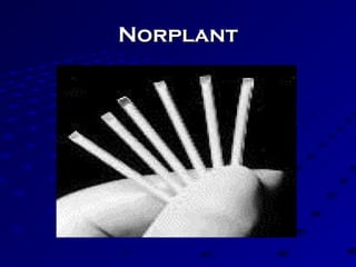 NorplantNorplant
 