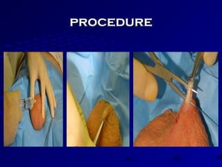 procedureprocedure
 