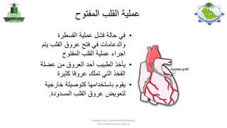 ‫عملية القلب المفتوح‬
‫• في حالة فشل عملية القسطرة‬
‫والدعامات في فتح عروق القلب يتم‬
‫اجراء عملية القلب المفتوح‬
‫• يأخذ الطبيب أحد العروق من عضلة‬
‫الفخذ التي تملك عروقا كثيرة‬
‫• يقوم باستخدامها كتوصيلة خارجية‬
‫لتعويض عروق القلب المسدودة.‬

‫,‪Prepared by Dr Nazeeh Sh Alothmany‬‬
‫‪http://nothmany.kau.edu.sa‬‬

 