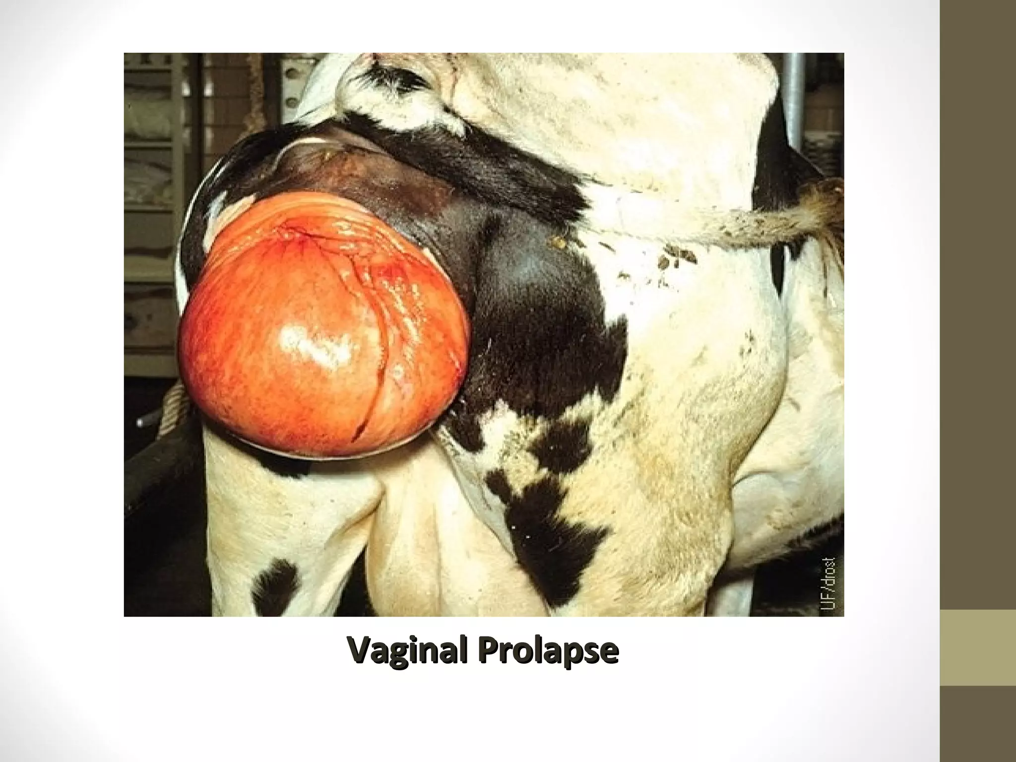 Vaginal Prolapse