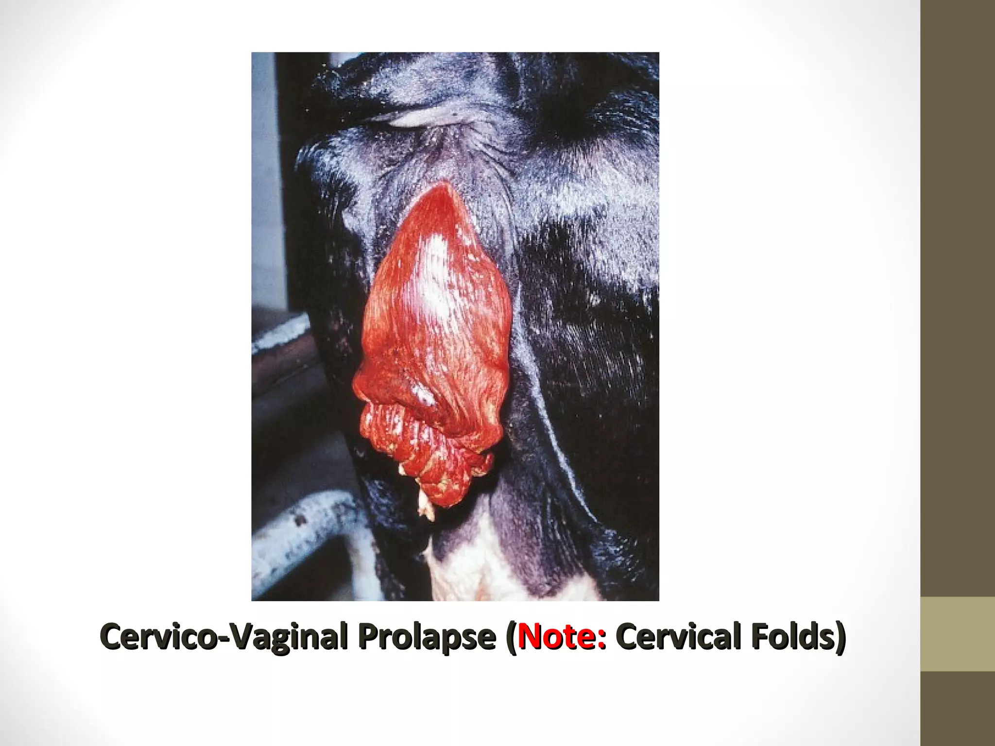 Cervico-Vaginal Prolapse ( Note: Cervical Folds)