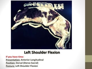 Left Shoulder Flexion If you have time: Presentation:  Anterior Longitudinal Position:  Dorsal (Dorso-Sacral) Posture:  Left Shoulder Flexion 