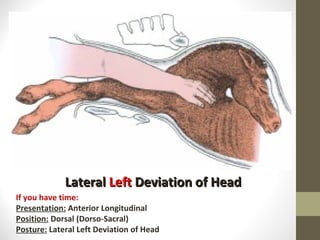 Lateral  Left  Deviation of Head If you have time: Presentation:  Anterior Longitudinal Position:  Dorsal (Dorso-Sacral) Posture:  Lateral Left Deviation of Head 