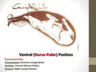 Ventral ( Dorso-Pubic ) Position If you have time: Presentation:  Anterior Longitudinal Position:  Ventral (Dorso-Pubic) Posture:  Right Carpal Flexion 