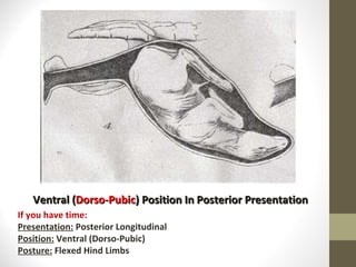 Ventral ( Dorso-Pubic ) Position In Posterior Presentation If you have time: Presentation:  Posterior Longitudinal Position:  Ventral (Dorso-Pubic) Posture:  Flexed Hind Limbs 