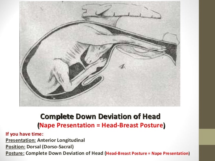 5th year practical revision fetal presentations