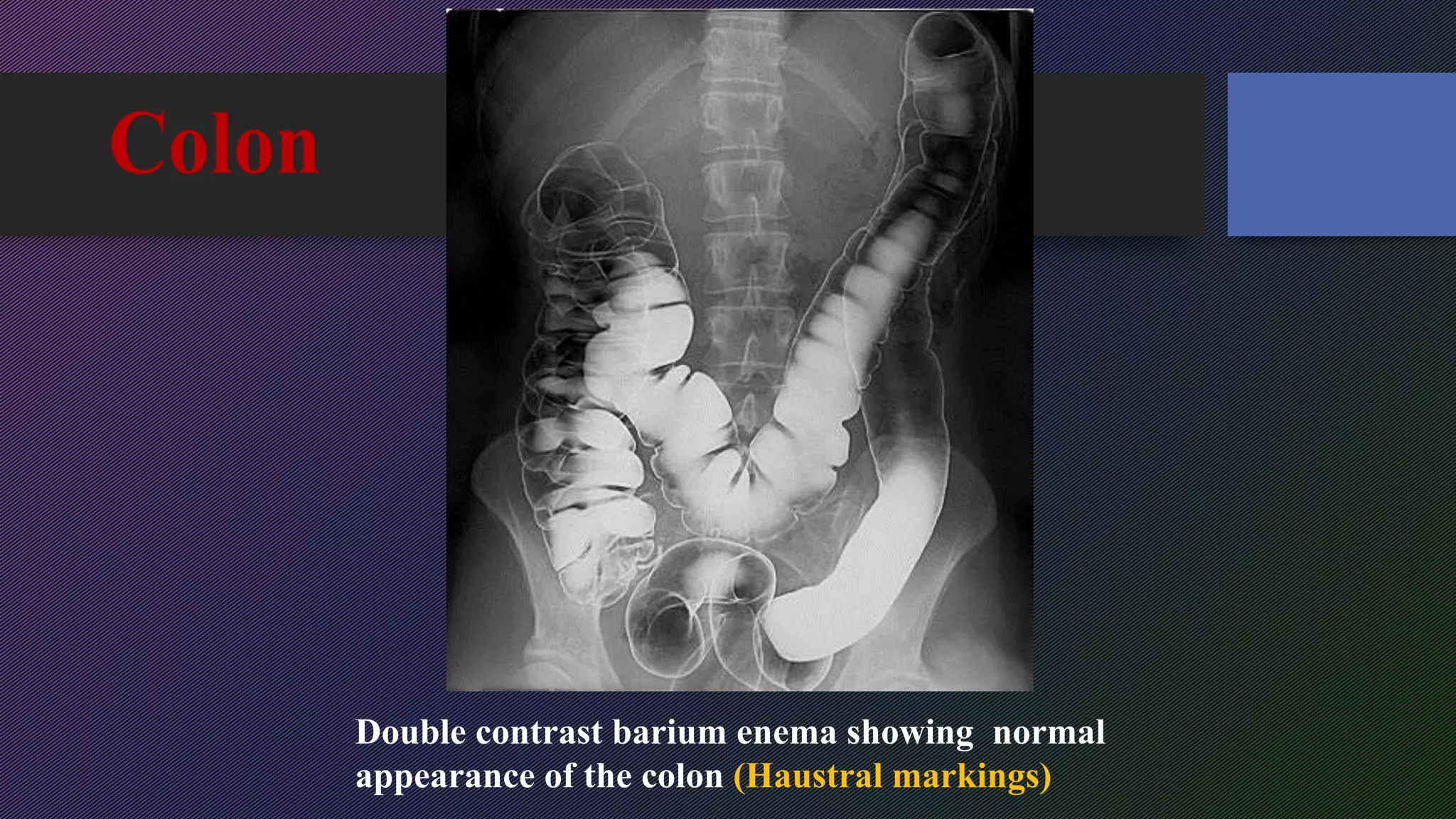 Haustral Activity 5th y radiology revision | PPTX