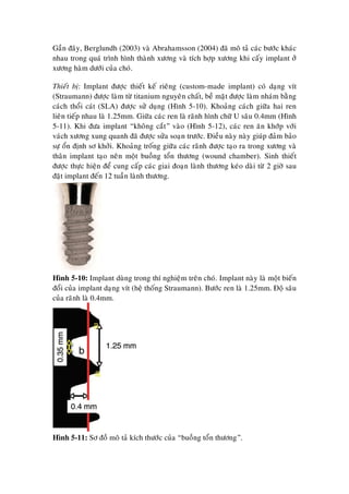 Gaàn ñaây, Berglundh (2003) vaø Abrahamsson (2004) ñaõ moâ taû caùc böôùc khaùc
nhau trong quaù trình hình thaønh xöông vaø tích hôïp xöông khi caáy implant ôû
xöông haøm döôùi cuûa choù.
Thieát bò: Implant ñöôïc thieát keá rieâng (custom-made implant) coù daïng vít
(Straumann) ñöôïc laøm töø titanium nguyeân chaát, beà maët ñöôïc laøm nhaùm baèng
caùch thoåi caùt (SLA) ñöôïc söû duïng (Hình 5-10). Khoaûng caùch giöõa hai ren
lieân tieáp nhau laø 1.25mm. Giöõa caùc ren laø raõnh hình chöõ U saâu 0.4mm (Hình
5-11). Khi ñöa implant “khoâng caét” vaøo (Hình 5-12), caùc ren aên khôùp vôùi
vaùch xöông xung quanh ñaõ ñöôïc söûa soaïn tröôùc. Ñieàu naøy naøy giuùp ñaûm baûo
söï oån ñònh sô khôûi. Khoaûng troáng giöõa caùc raõnh ñöôïc taïo ra trong xöông vaø
thaân implant taïo neân moät buoàng toån thöông (wound chamber). Sinh thieát
ñöôïc thöïc hieän ñeå cung caáp caùc giai ñoaïn laønh thöông keùo daøi töø 2 giôø sau
ñaët implant ñeán 12 tuaàn laønh thöông.
Hình 5-10: Implant duøng trong thí nghieäm treân choù. Implant naøy laø moät bieán
ñoåi cuûa implant daïng vít (heä thoáng Straumann). Böôùc ren laø 1.25mm. Ñoä saâu
cuûa raõnh laø 0.4mm.
Hình 5-11: Sô ñoà moâ taû kích thöôùc cuûa “buoàng toån thöông”.
 